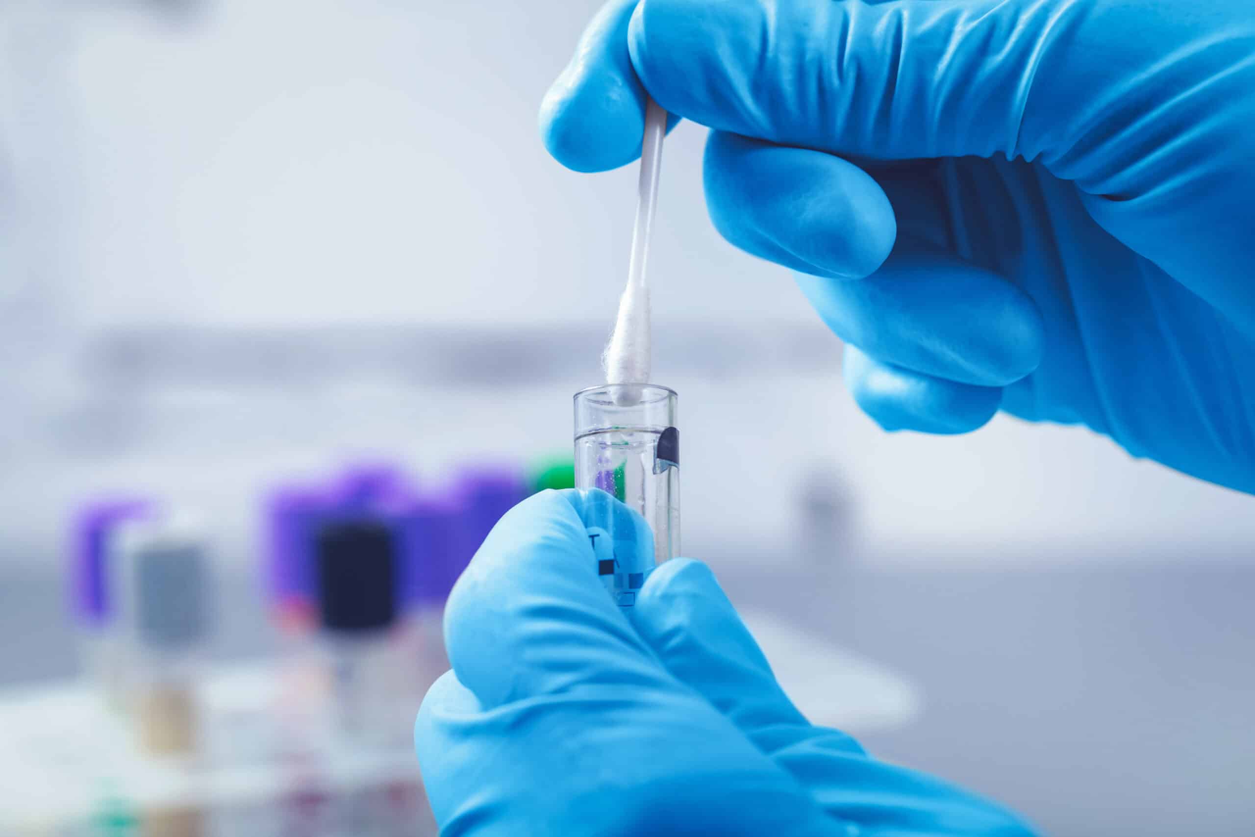 Medizinisches Fachpersonal mit blauen Schutzhandschuhen entnimmt einen Abstrich mit Wattestäbchen und Probenröhrchen – professionelle und hygienische Labordiagnostik in der Praxis Dr. med. Erdmute Kunstmann